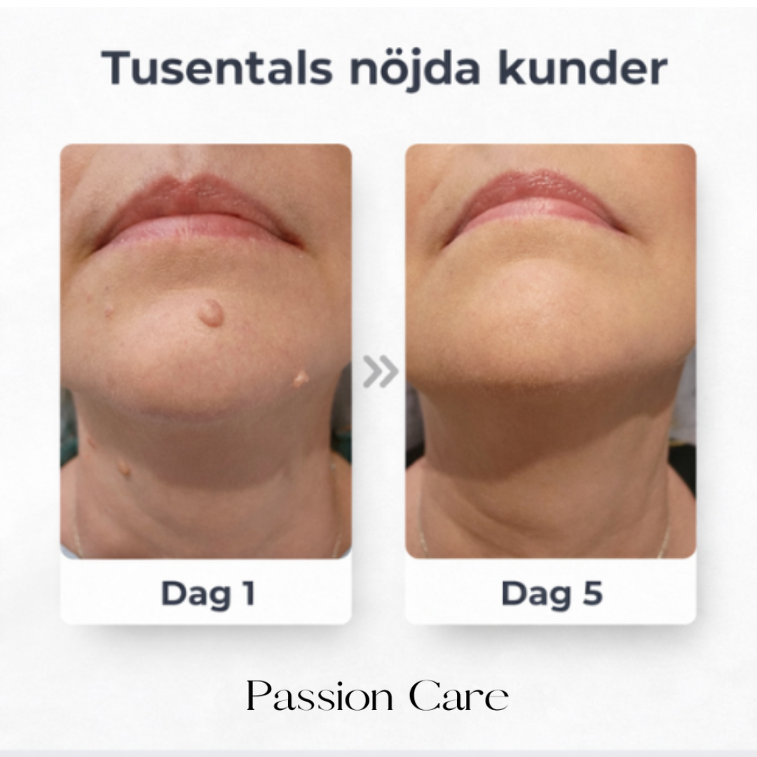 Passion Care - Hudvård Skin Patches