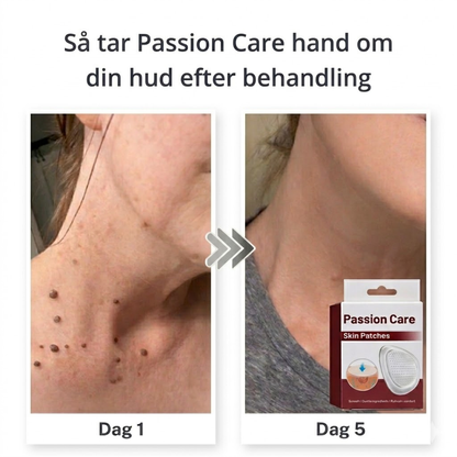 Passion Care - Hudvård Skin Patches
