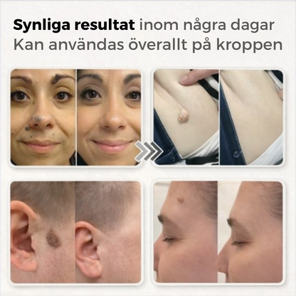 Passion Care - Hudvård Skin Patches
